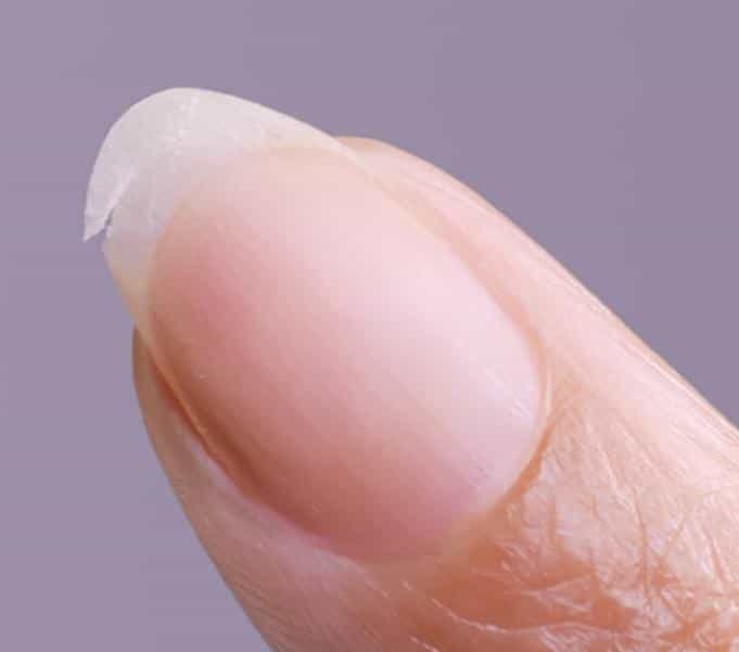 Nahaufnahme eines Fingernagels, der an der linken Seite eingerissen ist