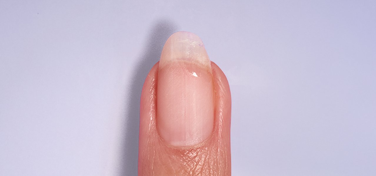 Ein Vorher-Nachher-Schieberegler, der einen gebrochenen Nagel (links) mit einem reparierten Nagel (rechts) vergleicht und die sofortige Nagelreparatur zeigt.