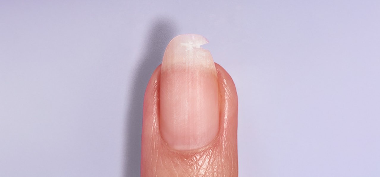 Ein Vorher-Nachher-Schieberegler, der einen gebrochenen Nagel (links) mit einem reparierten Nagel (rechts) vergleicht und die sofortige Nagelreparatur zeigt.