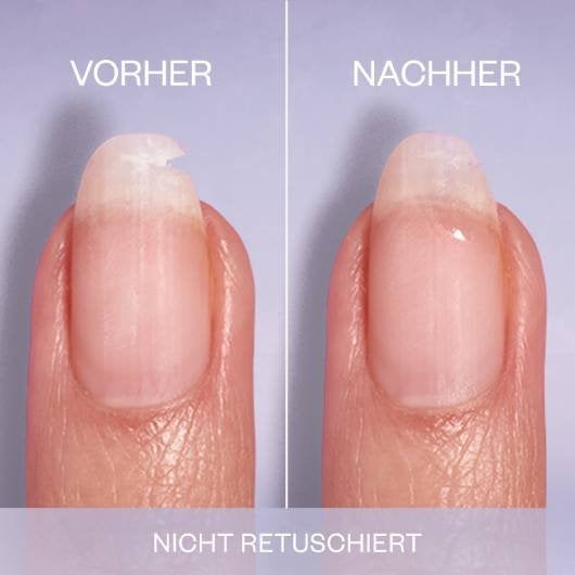 Vorher-Nacher-Vergleich eines Fingernagels nach dem Auftragen von Break Fix. Links vorher, rechts nachher.